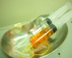 スポーツ選手の利用で話題 「ニンニク注射」とは何か？