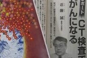 「CT検査でがんになる」　「放射線」専門家が衝撃レポート
