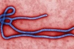 西アフリカでエボラ出血熱大流行か　ワクチンなし、致死率最高で90％の恐怖