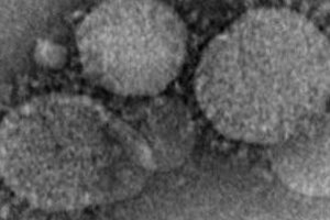 中東で感染拡大の「MERS」、感染者数を上方修正　「SARS」と同様の展開たどる？