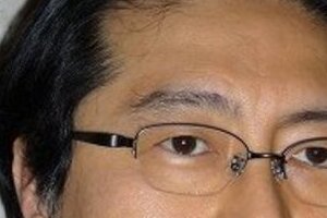 動脈硬化は見た目でわかる？　耳たぶ、目頭、アキレス腱に要注意