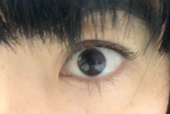 「ドライアイ」はその名のとおり目が乾いてカサつく