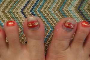 【男と女の相談室】「水虫なんてオヤジの病気」は大間違い　若い女性に多い「爪をボロボロにする」カビ