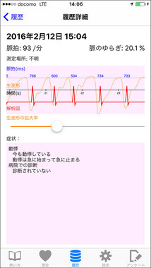 測定結果の画面。脈の揺らぎは波形とともに表示される