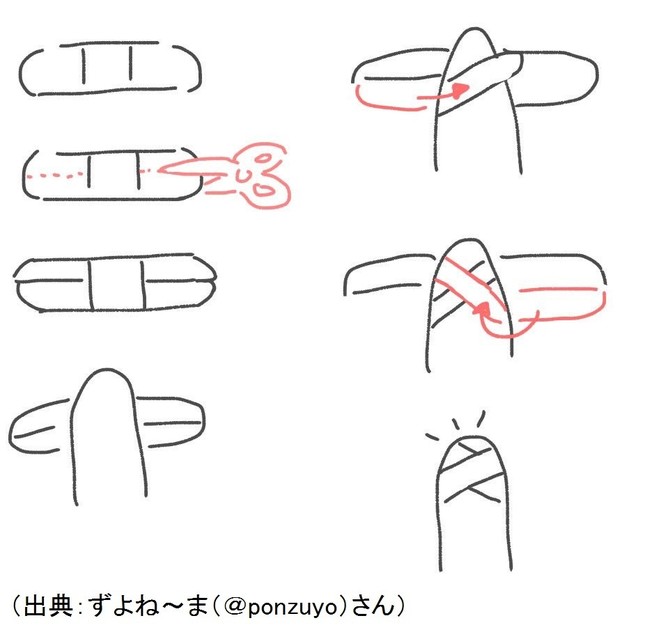 絆創膏の貼り方に大きな反響が出た（出典：ずよね～ま（＠ponzuyo）さん）