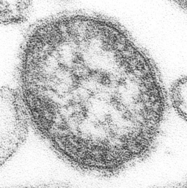 感染力はインフルエンザよりもはるかに高い（画像は麻しんウイルス CDC, Cynthia Goldsmith）