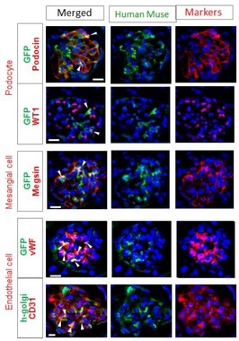 実験のうち、正常な免疫機能を持つマウスでのMuse細胞の糸球体細胞への分化を示した画像（東北大の発表資料より）

