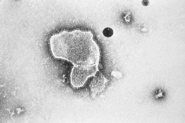 RSウイルスの電子顕微鏡像（米疾病予防管理センター）