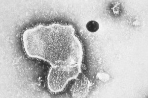 RSウイルス大流行、赤ちゃん要注意　夏でも感染拡大もはや危険水域