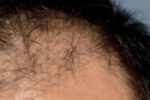 「ハゲは怒ってます」と声をかけられた　豊田真由子候補の返答がテレビで流れる