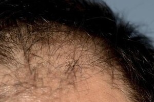 流行語大賞、「ハゲ」に忖度か　「ちーがーうーだーろー！」は「ちーがーうーだーろー！」