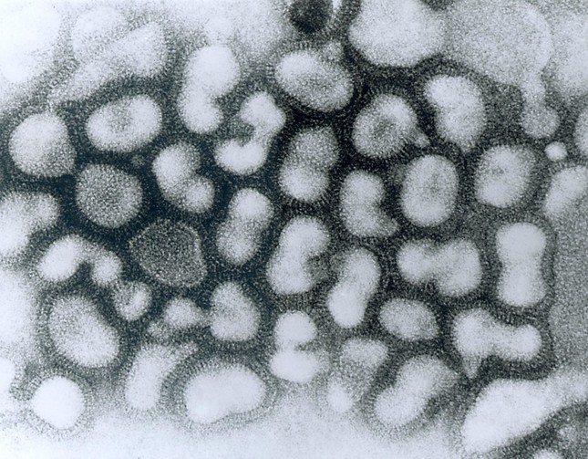 高病原性鳥インフルエンザウイルス（米CDC）

