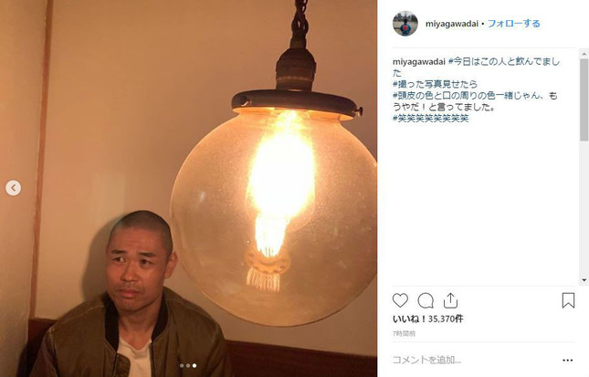 頭皮の色と口の周りの色に注目の品川祐さん