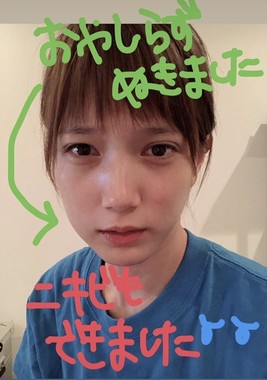 本田翼 仕事ng級の顔腫れも 可愛すぎる 親知らず抜歯でファン射止める J Cast ニュース