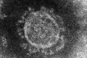 新型コロナ感染者「その後」は？　どれくらいの患者が回復したのか