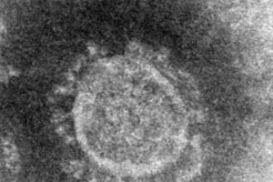 「コロナウイルス」商標出願　無関係とみられるが...社長「将来的な使用を計画」