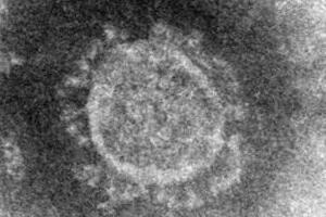 「4週間後に感染者600人」都医師会が予測的中　では「さらに4週間後」は...？