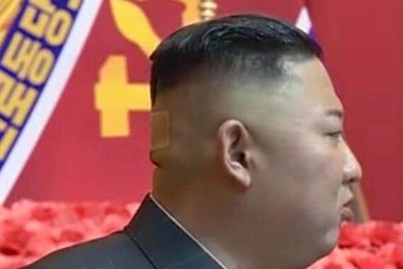 7月24日から27日にかけて行われた「朝鮮人民軍第1回指揮官・政治活動家講習会」で、金正恩総書記は絆創膏姿で登壇した（写真は朝鮮中央テレビから）