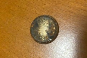 「数分目を離した隙に...」2歳息子がボタン電池誤飲　即搬送も緊急入院、リスク伝えた母親体験談に注目