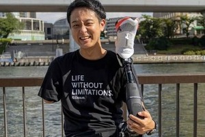 「障害者手帳があって本当に良かった」　どんな場面で使う？手足3本失った男が感じるありがたみ