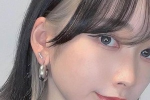 整形直後に下向いたら「目から血がバーッて出てきた」　人気YouTuberを襲った恐怖のアクシデント