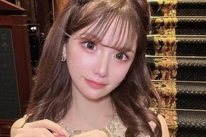 「ブスすぎる」中傷された人気インフルエンサー　1000万円整形のビフォーアフターにSNS衝撃「こんな変わるん！？」