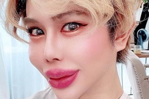 「日本一の整形男子」アップデート報告が物議　「やりすぎ」指摘相次ぐも...医師反論「他人が横から口を出すのは違う」