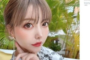 「こんな額になりたいですか？」　整形2000万モデル、美容注射でまさかの悲劇...「頭部肥大」衝撃姿を公開