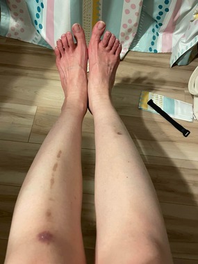 素足の写真、タビオに取り上げられたXユーザー「氷月（ひづき）」（＠ghiaccio_mese）さんの投稿より