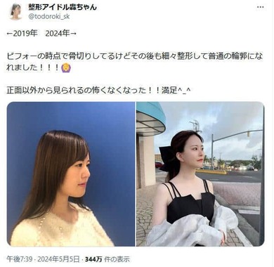 整形アイドル轟ちゃんのXより