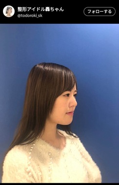 整形アイドル轟ちゃんのXより