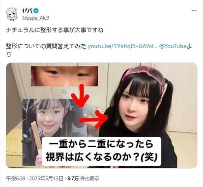 整形についてさまざまな疑問に答えた。写真はゼパさんのXから