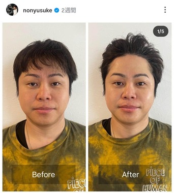 井上裕介さんのインスタグラム（＠nonyusuke）より
