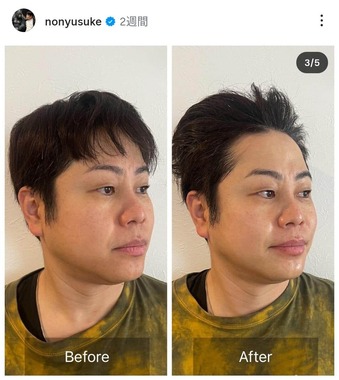 井上裕介さんのインスタグラム（＠nonyusuke）より