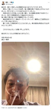 入院先からXを更新。右目のまわりが黒くはれている