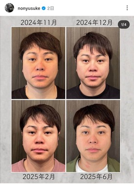 井上裕介さんのインスタグラム（＠nonyusuke）より