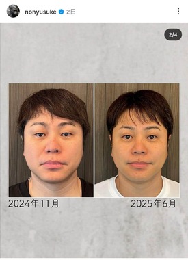 井上裕介さんのインスタグラム（＠nonyusuke）より
