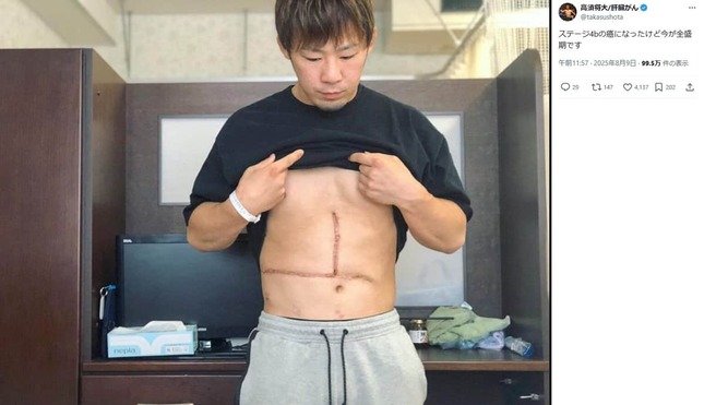 高須将大さんのX（＠takasushota）より