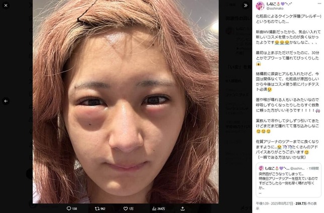 しなこさんのX（＠ssshinako）より