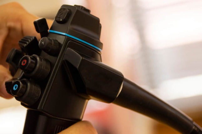 胃の異変で内視鏡検査（写真はイメージ）