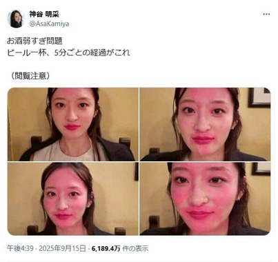 ピール1杯でこんなに赤く…。心配の声が相次いでいる
