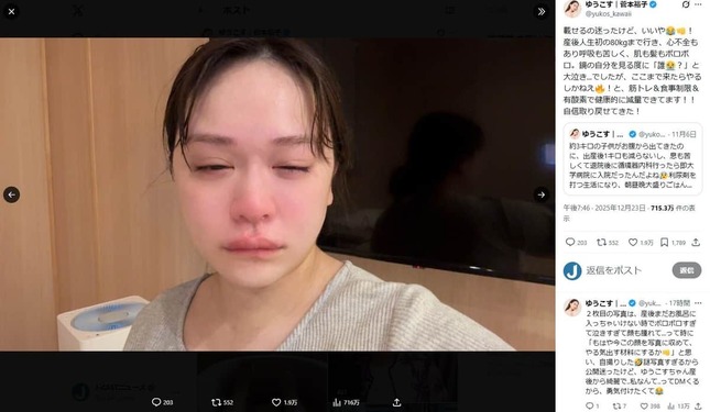 ゆうこすさんのX（＠yukos_kawaii）より。出産前後の変化を報告している