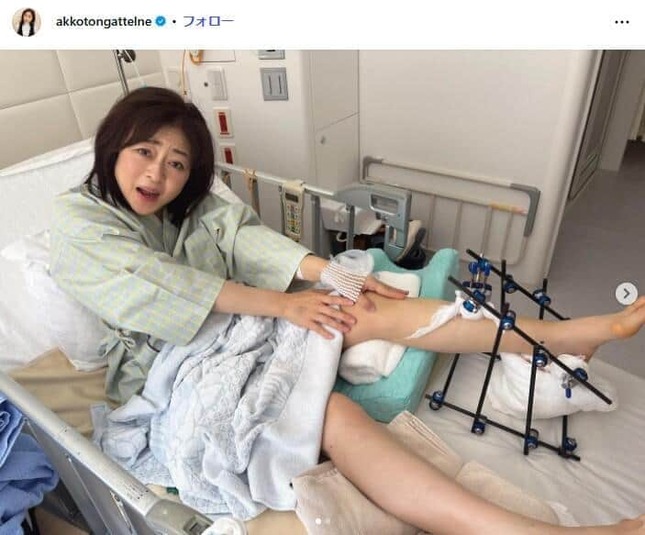 松本明子さんのインスタグラム（＠akkotongattelne）より