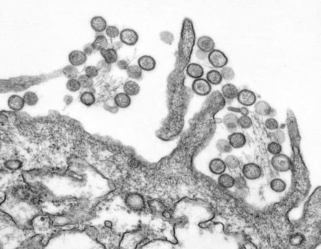 ハンタウイルスのリスクはどの程度なのか。写真は米疾病予防管理センター（CDC）の公衆衛生画像ライブラリ（PHIL）から