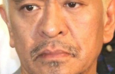 松本人志「飛び出てる腸を戻す」手術のため一時休養へ　笑い交え報告「思ったより元気そう」「筋肉戻ってる！？」