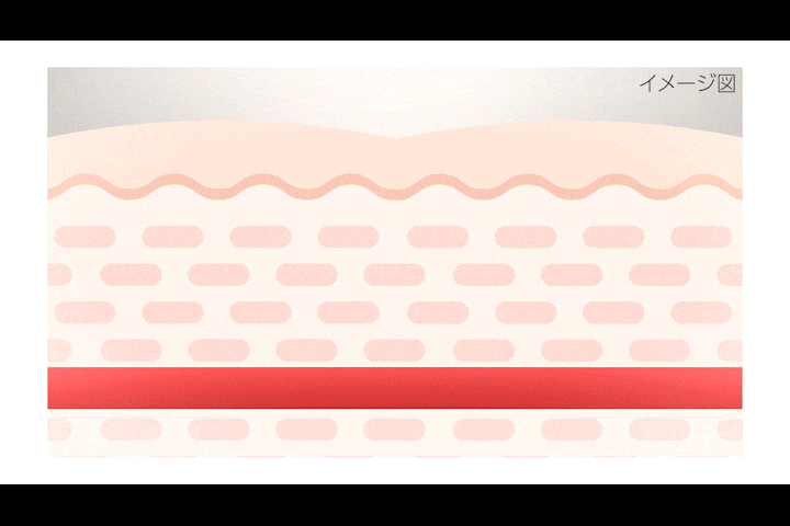 トラネキサム酸は、炎症に関わる物質を誘発するプラスミンを抑える働きがある