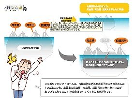 メタボを解説する厚労省のHP