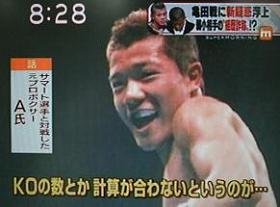 亀田大毅選手の「戦績詐称疑惑」について報じる10月24日の「スーパーモーニング」（テレビ朝日から）