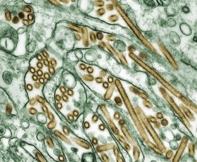 「H5N1」ウイルスの顕微鏡画像。これが大流行したら一大事だ（WIKIMEDIA COMMONSより）