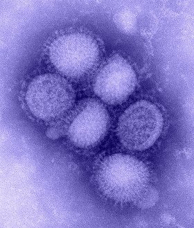 油断するな、今年のインフルエンザ　タミフルが効かない耐性ウイルスや、鳥インフル…
